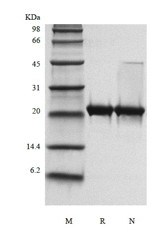 SDS-PAGE of Recombinant Murine Ciliary Neurotrophic Factor